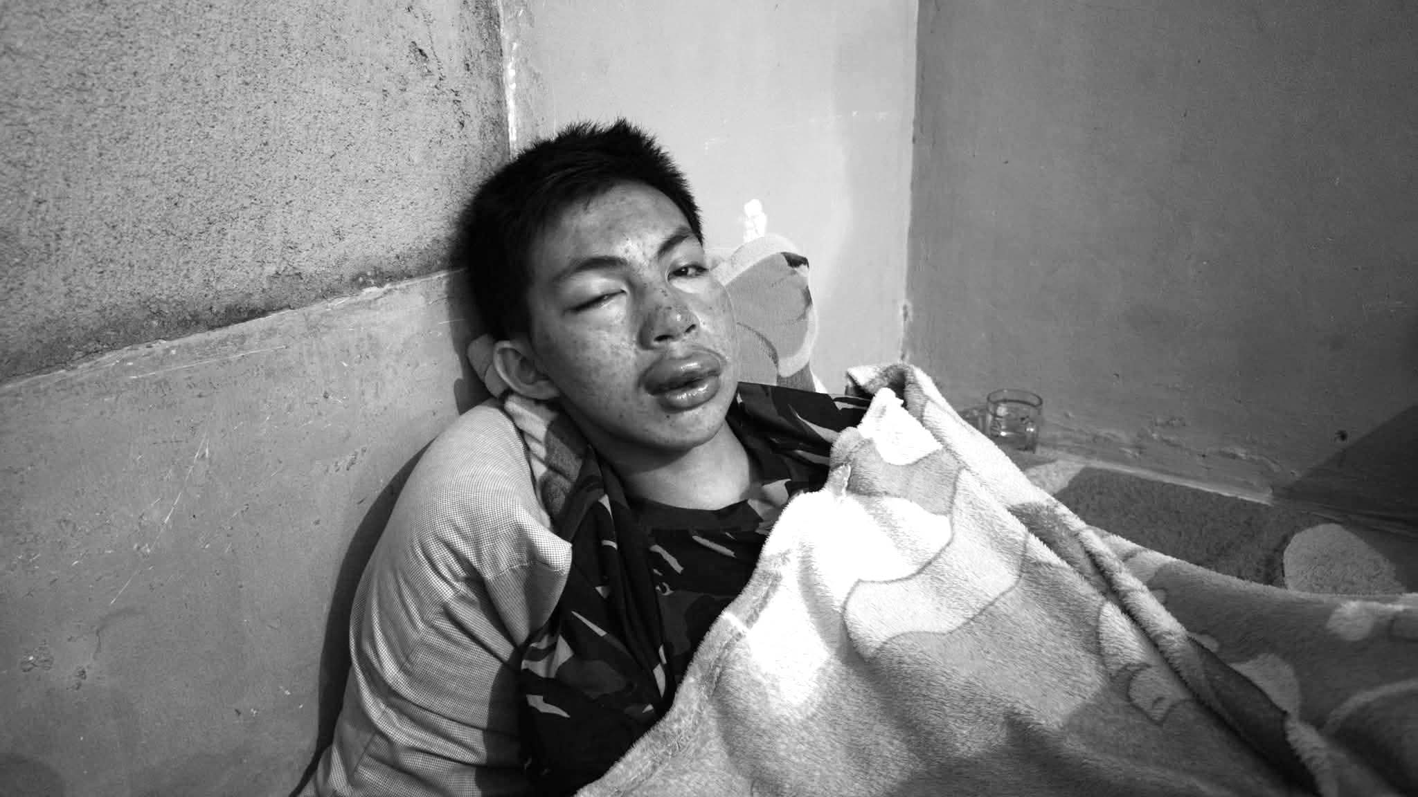 Remaja di Sukabumi Nyaris Tewas