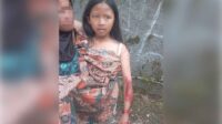 Viral Bocah Perempuan Luka Parah jadi Korban Begal HP di Sukaraja Sukabumi